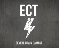 ECT